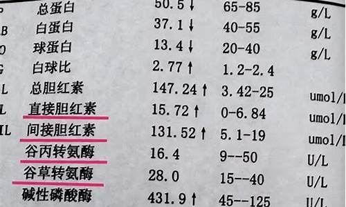 高考体检转氨酶标准_高考体检转氨酶标准是多少